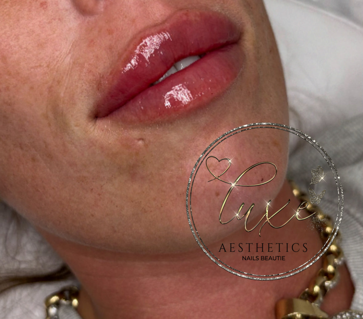 Lips & Lines Package 💋
